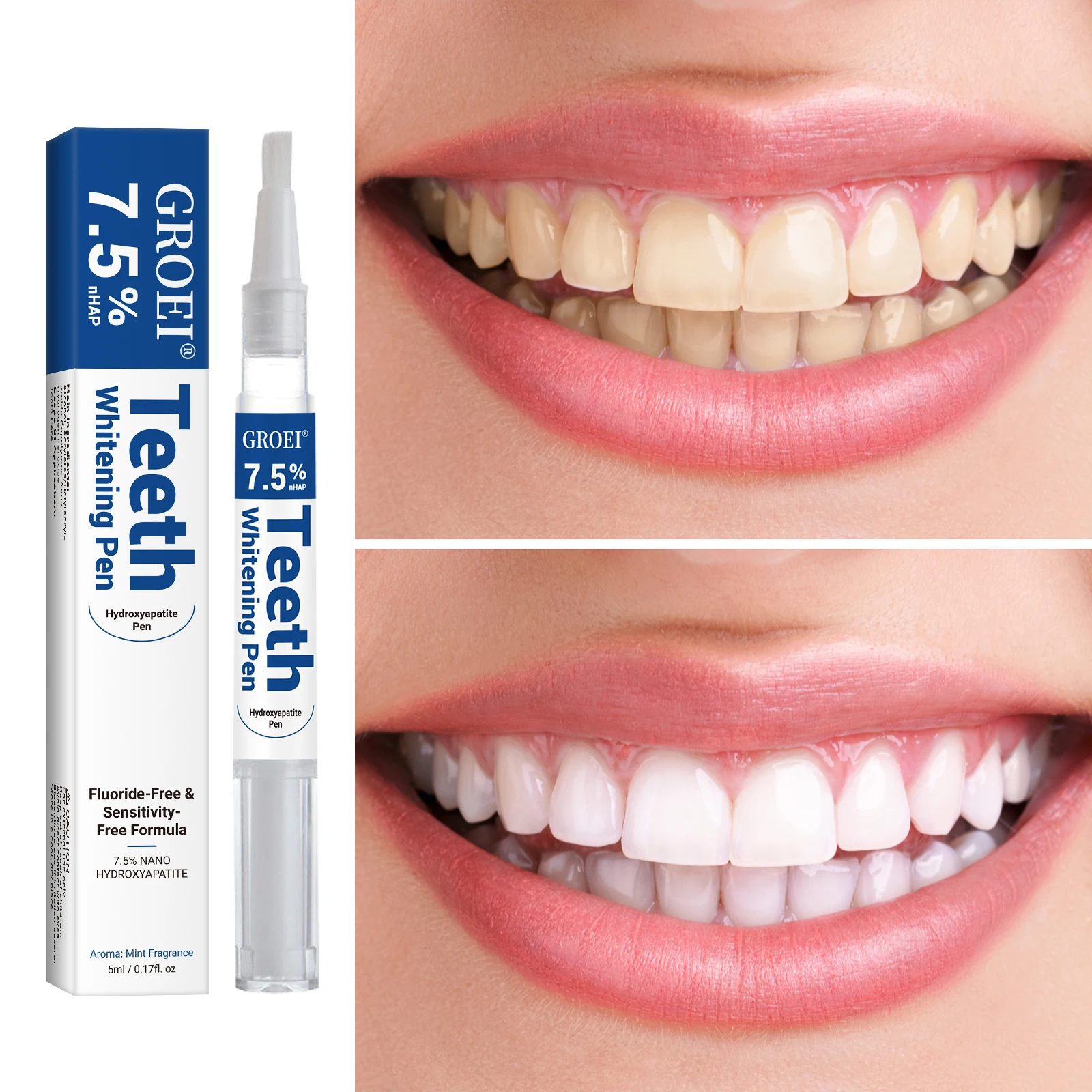 Hydroxyapatite Tooth Whitening - đánh giá và giá Teeth Whitening Ai