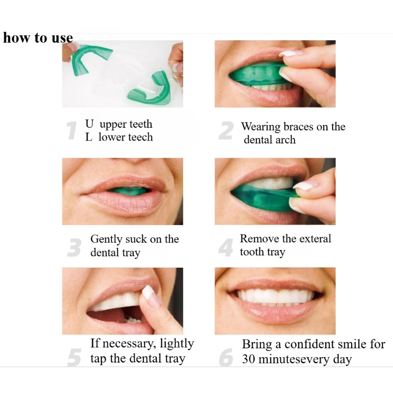 Set Teeth Whitening Tray U-sha - đánh giá và giá Teeth Whitening From Home