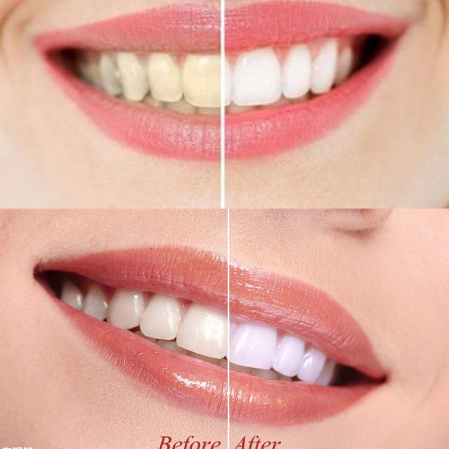 Bamboo Charcoal Teeth Tooth De - đánh giá và giá Teeth Whitening Yellow Teeth