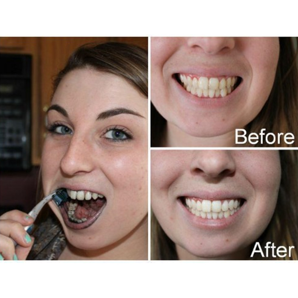 Bamboo Charcoal Teeth Tooth De - đánh giá và giá Teeth Whitening Yellow Teeth