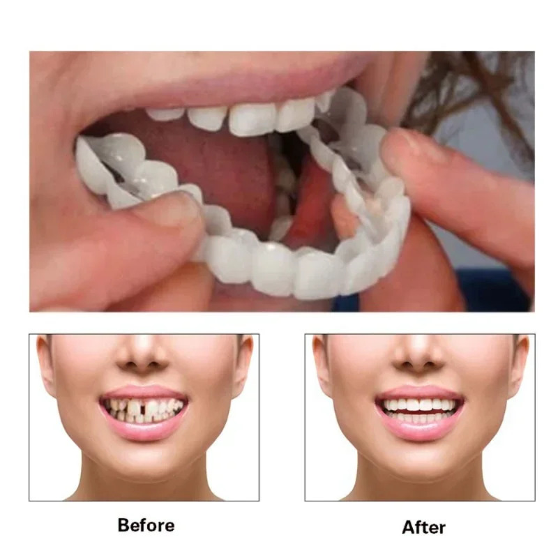 Quick Makeup Teeth Veneers, In - đánh giá và giá Teeth Whitening Fast