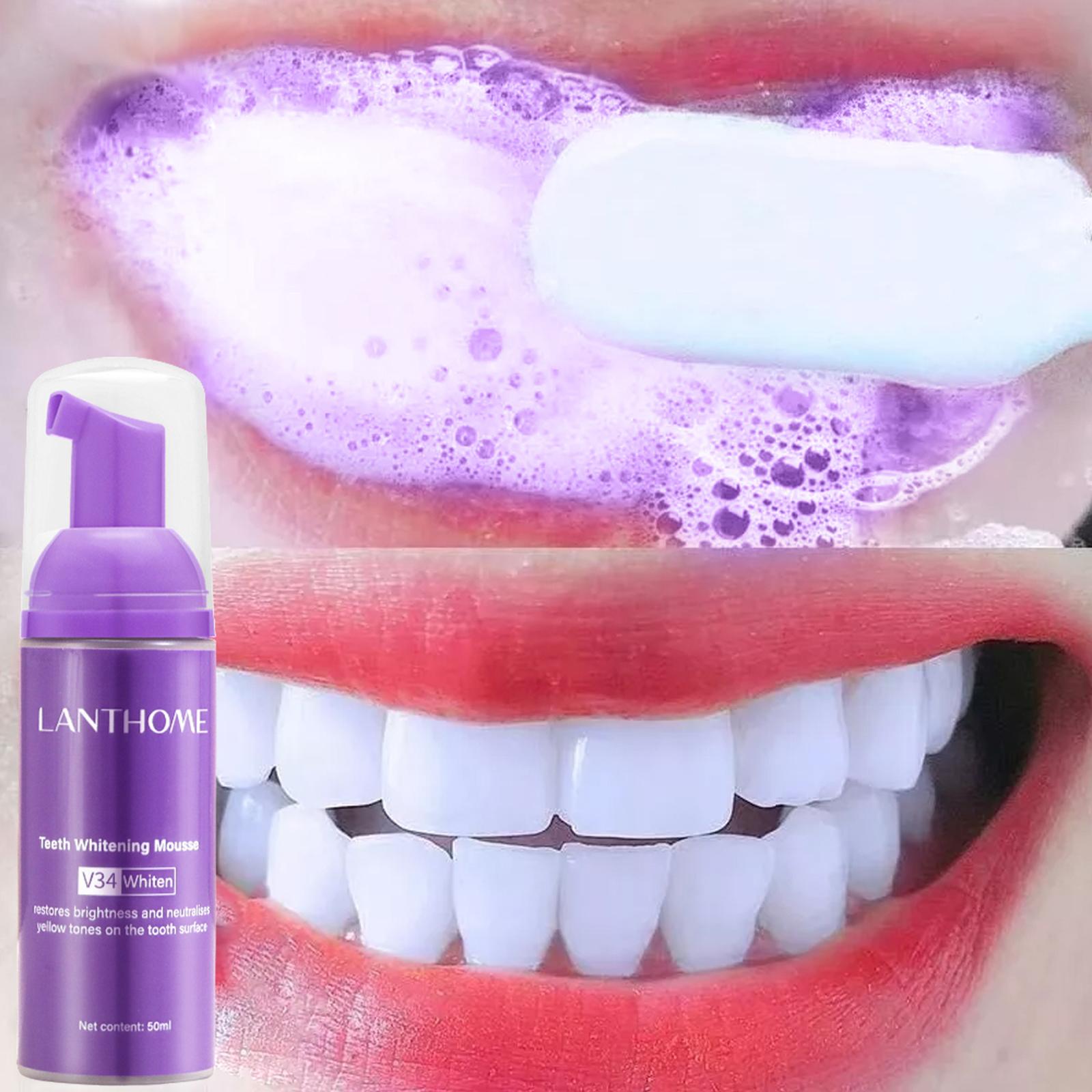 V34 Mousse Teeth Cleaning Toot - đánh giá và giá Teeth Whitening Yellow Teeth