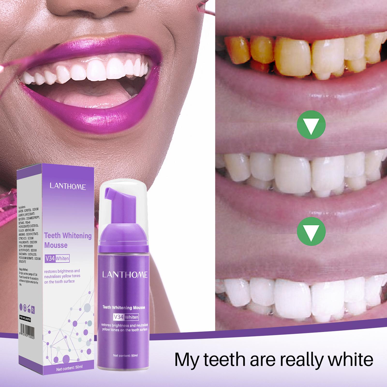 V34 Mousse Teeth Cleaning Toot - đánh giá và giá Teeth Whitening Yellow Teeth