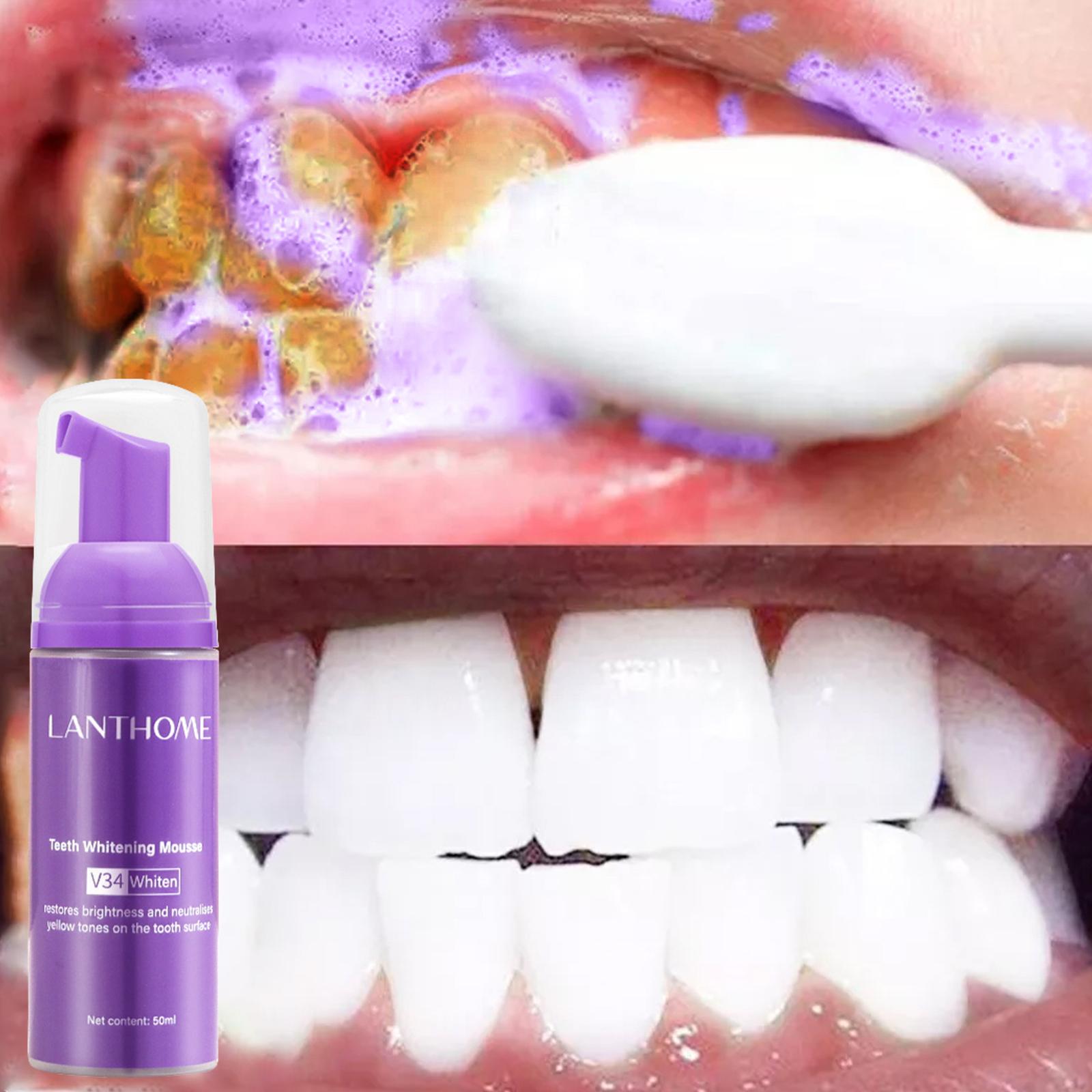 V34 Mousse Teeth Cleaning Toot - đánh giá và giá Teeth Whitening Yellow Teeth