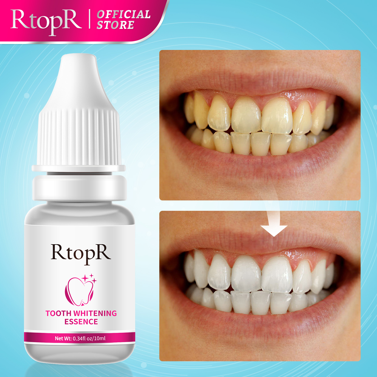 Tooth Whitening Serum Whitenin - đánh giá và giá Teeth Whitening Xylitol