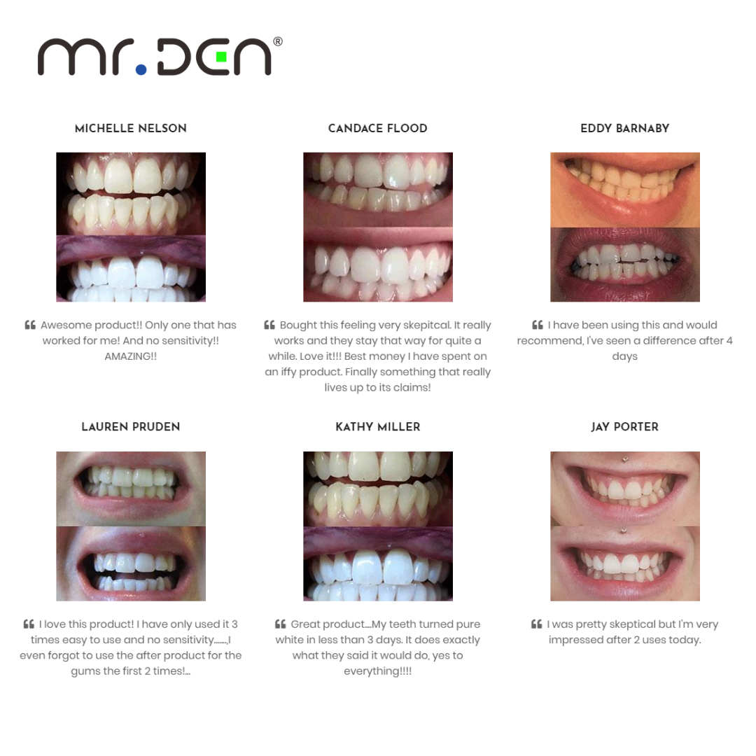 Dr. Whiten 3 Pack Teeth Whiten - đánh giá và giá Teeth Whitening Light
