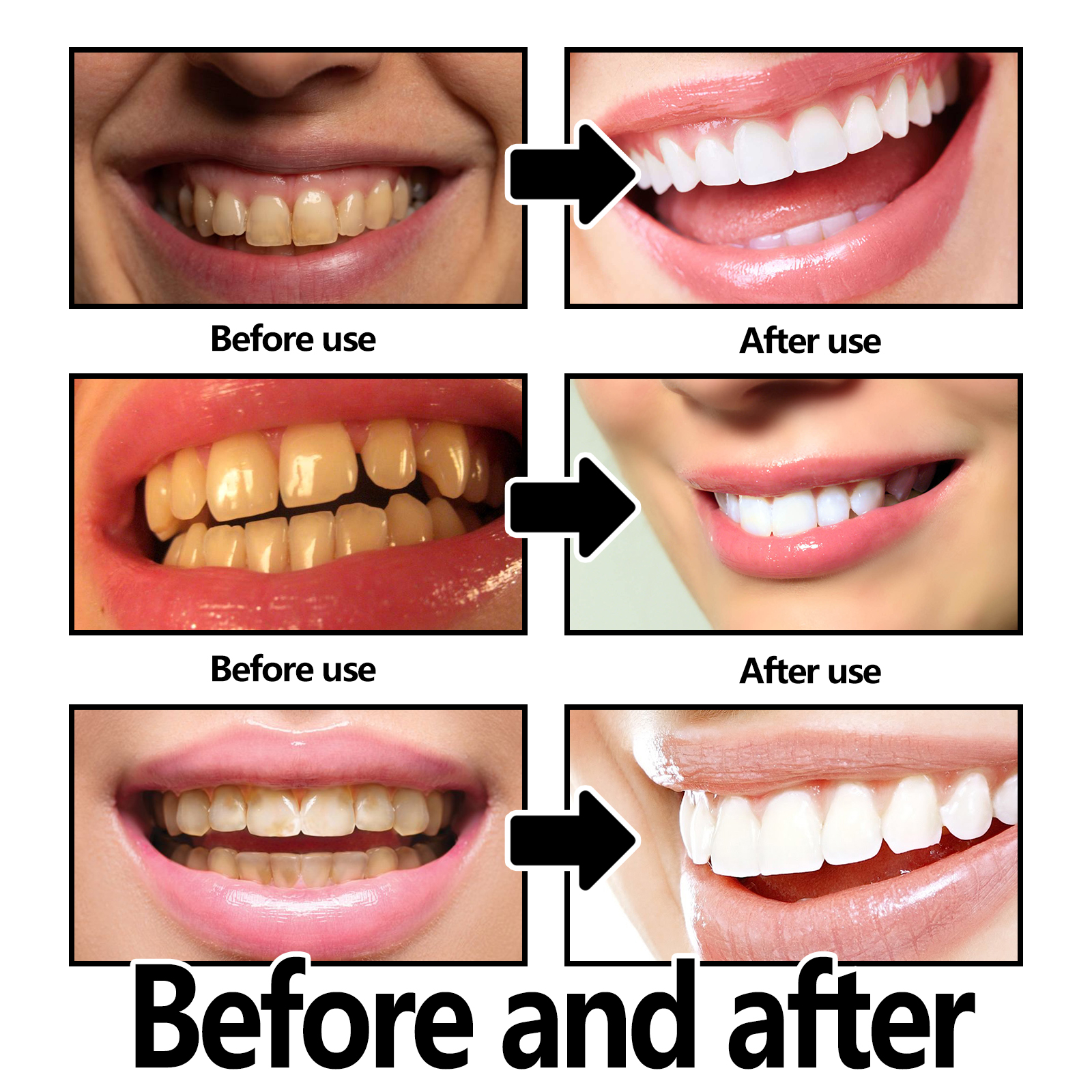 Xylitol Mint Purple Toothpaste - đánh giá và giá Teeth Whitening Xylitol