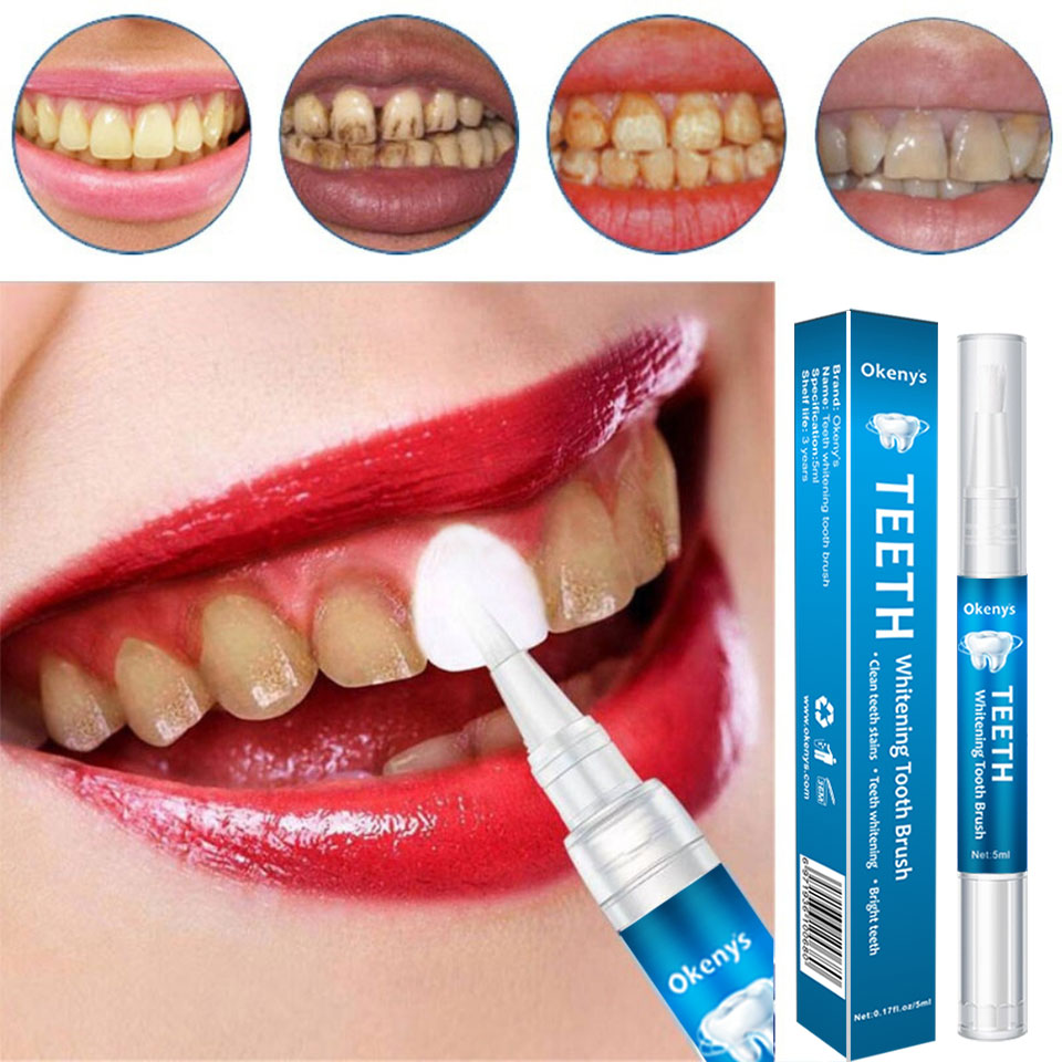 5ml Teeth Whitening Kit Clean  - đánh giá và giá Teeth Whitening Xylitol