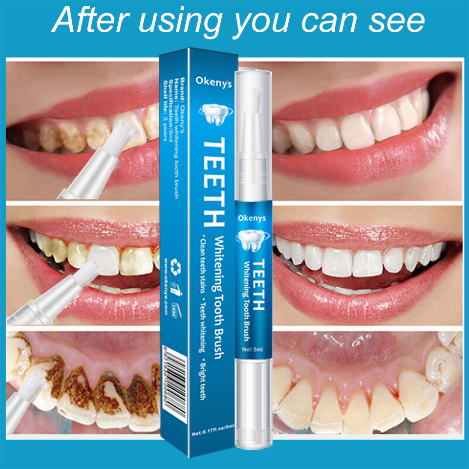 5ml Teeth Whitening Kit Clean  - đánh giá và giá Teeth Whitening Xylitol