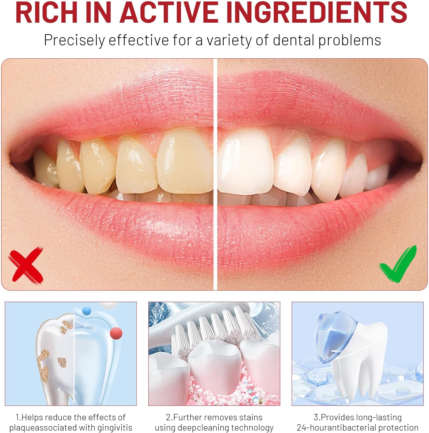 Niacinamide Whitening Toothpas - đánh giá và giá Teeth Whitening That Works