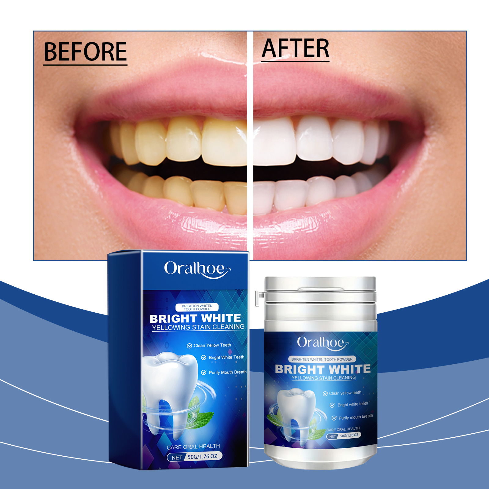 Mint Xylitol Teeth Restoration - đánh giá và giá Teeth Whitening Xylitol