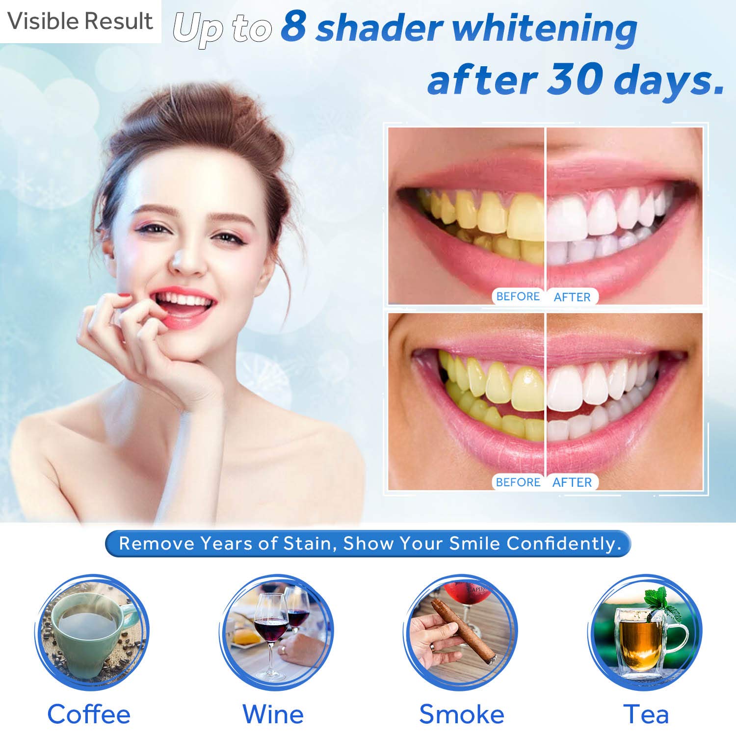 Teeth Whitening Gel Refill Syr - đánh giá và giá Teeth Whitening Uv Light