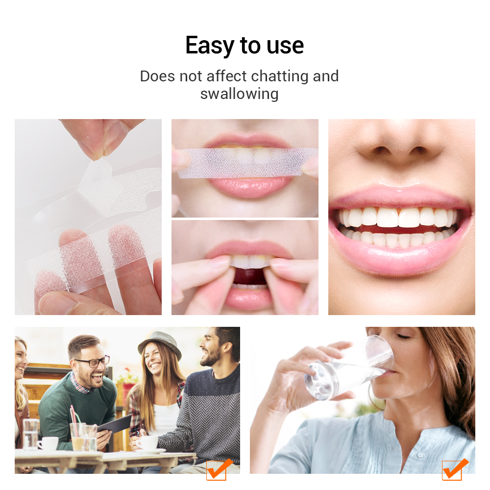 5D Teeth Whitening Strips Remo - đánh giá và giá Teeth Whitening Yellow Teeth