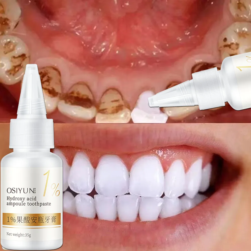 Teeth Whitening Toothpaste Fru - đánh giá và giá Teeth Whitening Xylitol