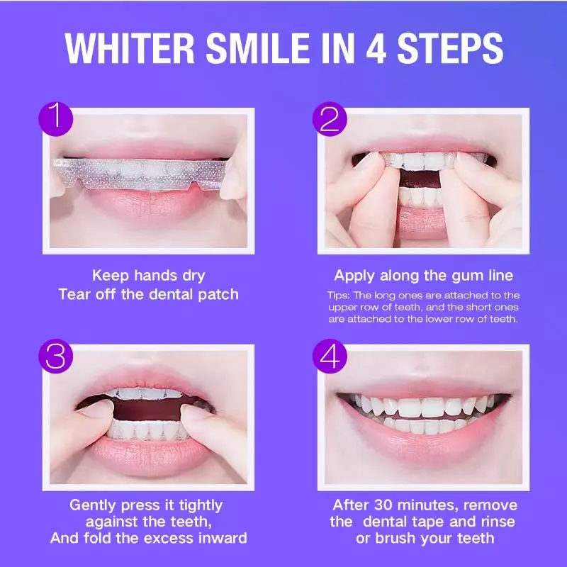 Teeth Whitening Kit - 5X LED L - đánh giá và giá Teeth Whitening From Home