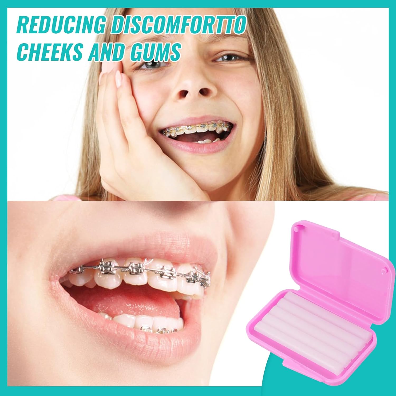 10box Dental Orthodontic Relie - đánh giá và giá Teeth Whitening Gum