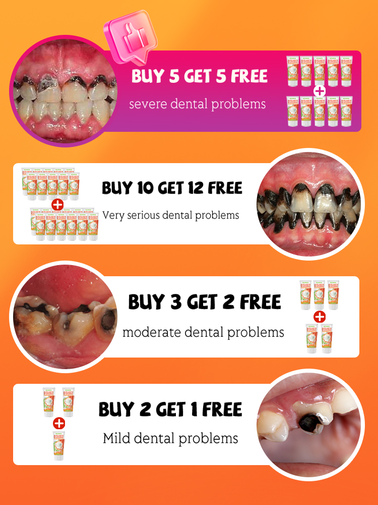 Repair tooth decay and whiten  - đánh giá và giá Teeth Whitening That Works