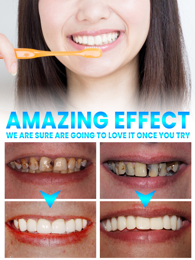 Repair tooth decay and whiten  - đánh giá và giá Teeth Whitening That Works