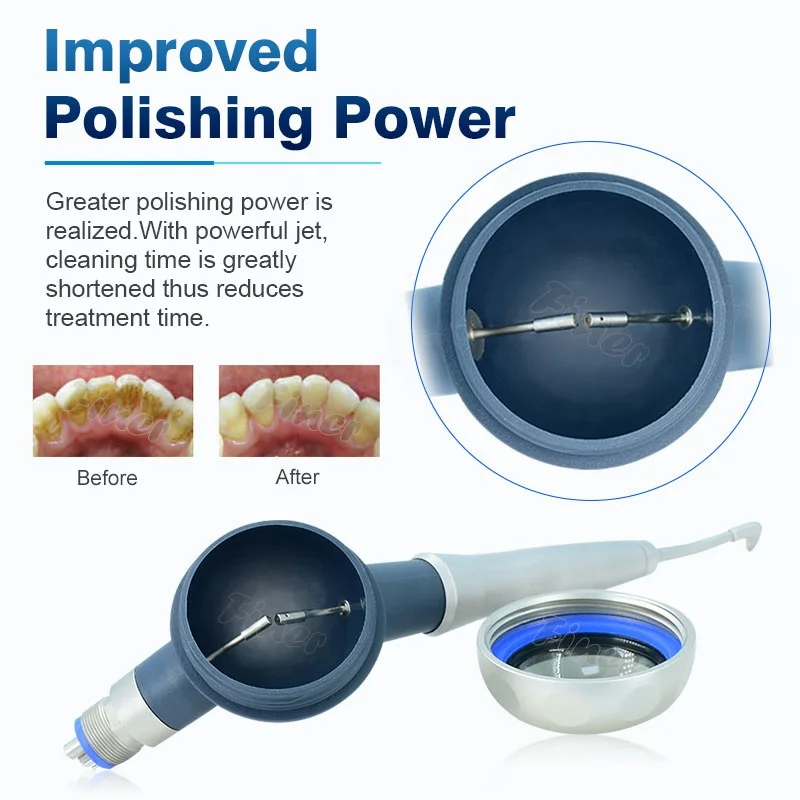 Prophy Mate Teeth Cleaning Whi - đánh giá và giá Teeth Whitening Fast