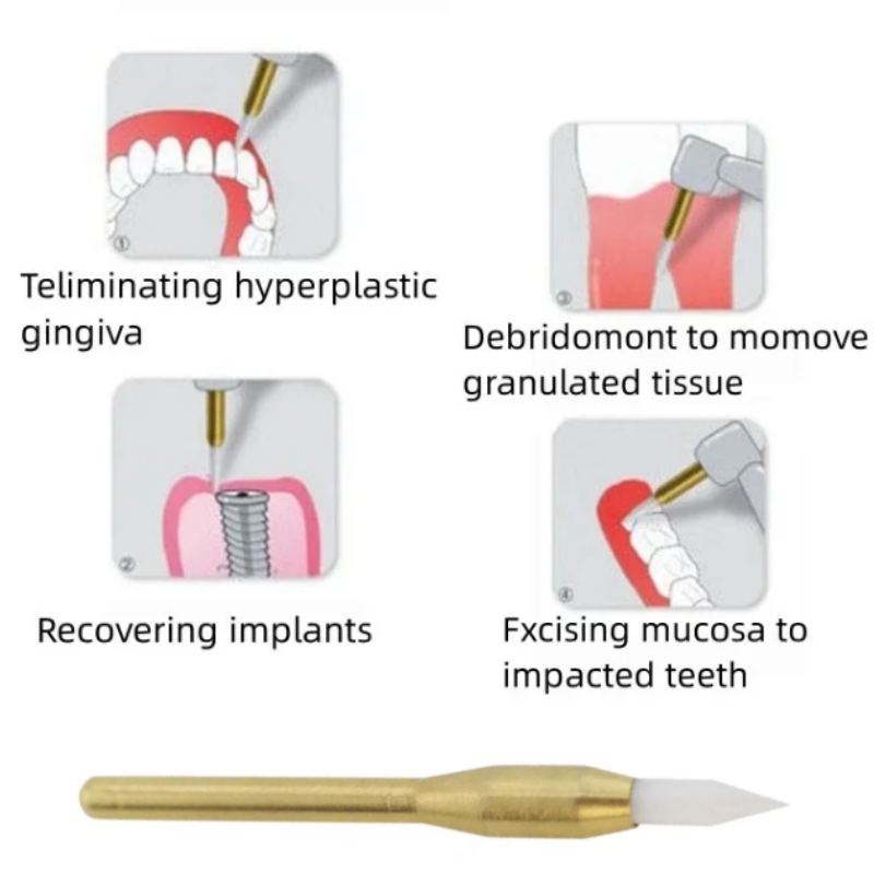 Dental Soft Trimmer Burs Surgi - đánh giá và giá Teeth Whitening Gum