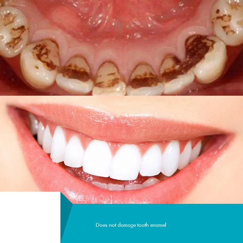 Herbal Tooth Powder, Natural T - đánh giá và giá Teeth Whitening Xylitol