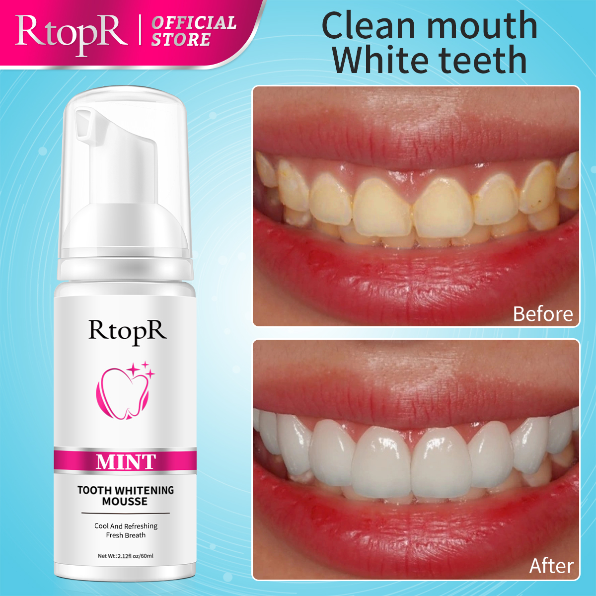 RtopR Mint Whitening Teeth Mou - đánh giá và giá Teeth Whitening Xylitol