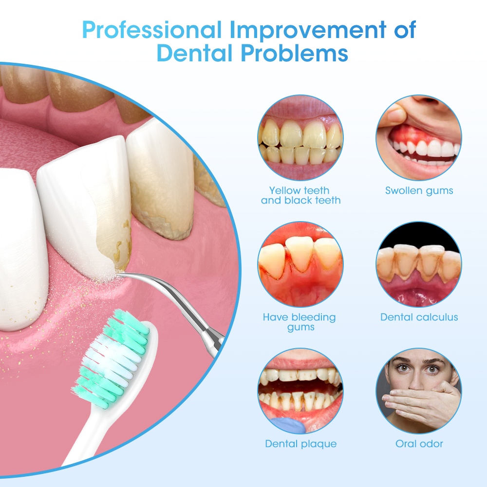 Electric Teeth Cleaner Sonic D - đánh giá và giá Teeth Whitening Toothbrush
