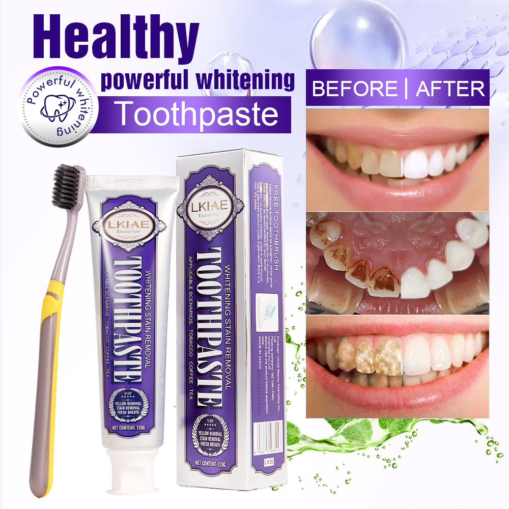 LKIAE White Teeth Whitening To - đánh giá và giá Teeth Whitening Toothpaste