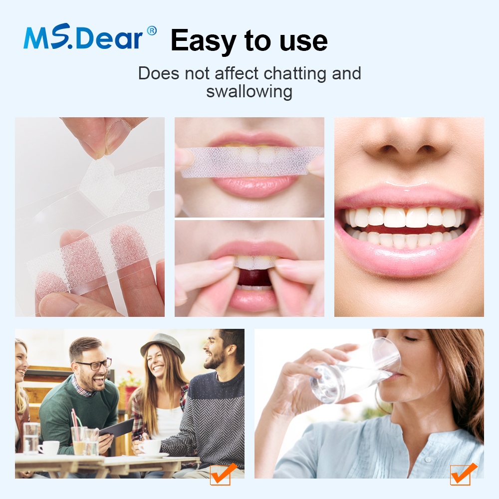 Teeth Whitening Strips Cleansi - đánh giá và giá Teeth Whitening From Home